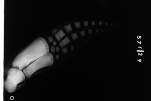 Ein Röntgenbild eines menschlichen Beins mit einer sichtbaren Fraktur am Knöchel, mit Text auf der rechten Seite vor einem schwarzen Hintergrund.